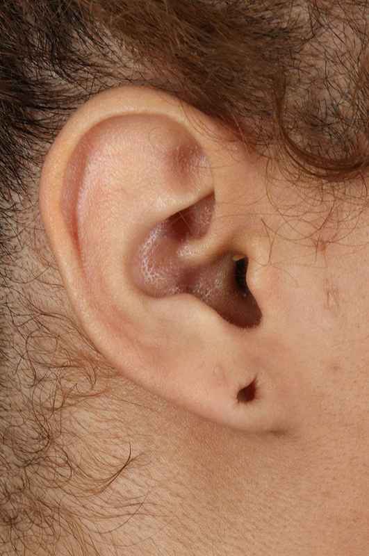 Earlobe Repair Before & After Patient #1791